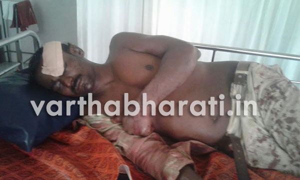 ಕುಡಿತದ ನಶೆಯಲ್ಲಿ ಕತ್ತಿಯಿಂದ ಕಡಿದು ಹಲ್ಲೆ: ಆರೋಪಿ ಪೊಲೀಶ್ ವಶಕ್ಕೆ